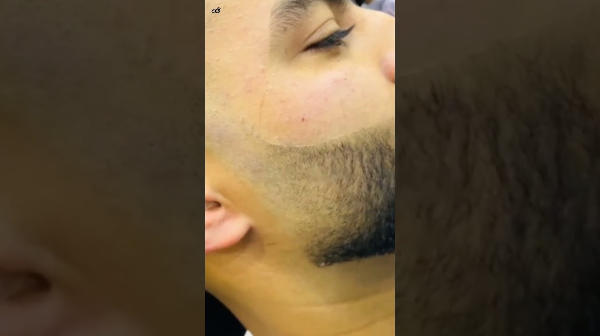 Beard Beard Beard #adi #skincare #viral Beard Beard Beard #adi #skincare #viral