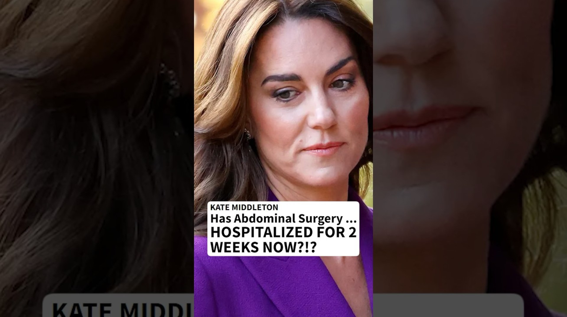 #KateMiddleton โ aka Catherine, Princess of Wales โ has been hospitalized. #RoyalFamily #KingCharles #KateMiddleton โ aka Catherine, Princess of Wales โ has been hospitalized. #RoyalFamily #KingCharles