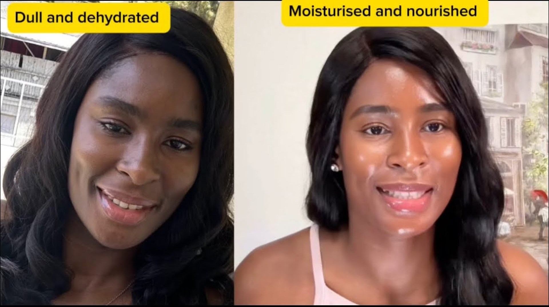 How I Achieved Attractive, Glowing Black Skin | Ingredients & Products That Works. Body Care How I Achieved Attractive, Glowing Black Skin | Ingredients & Products That Works. Body Care