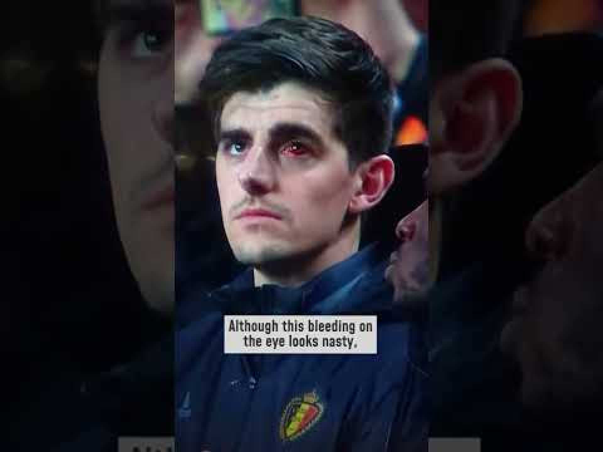 Did a bloody eye stop Thibaut Courtois? Did a bloody eye stop Thibaut Courtois?