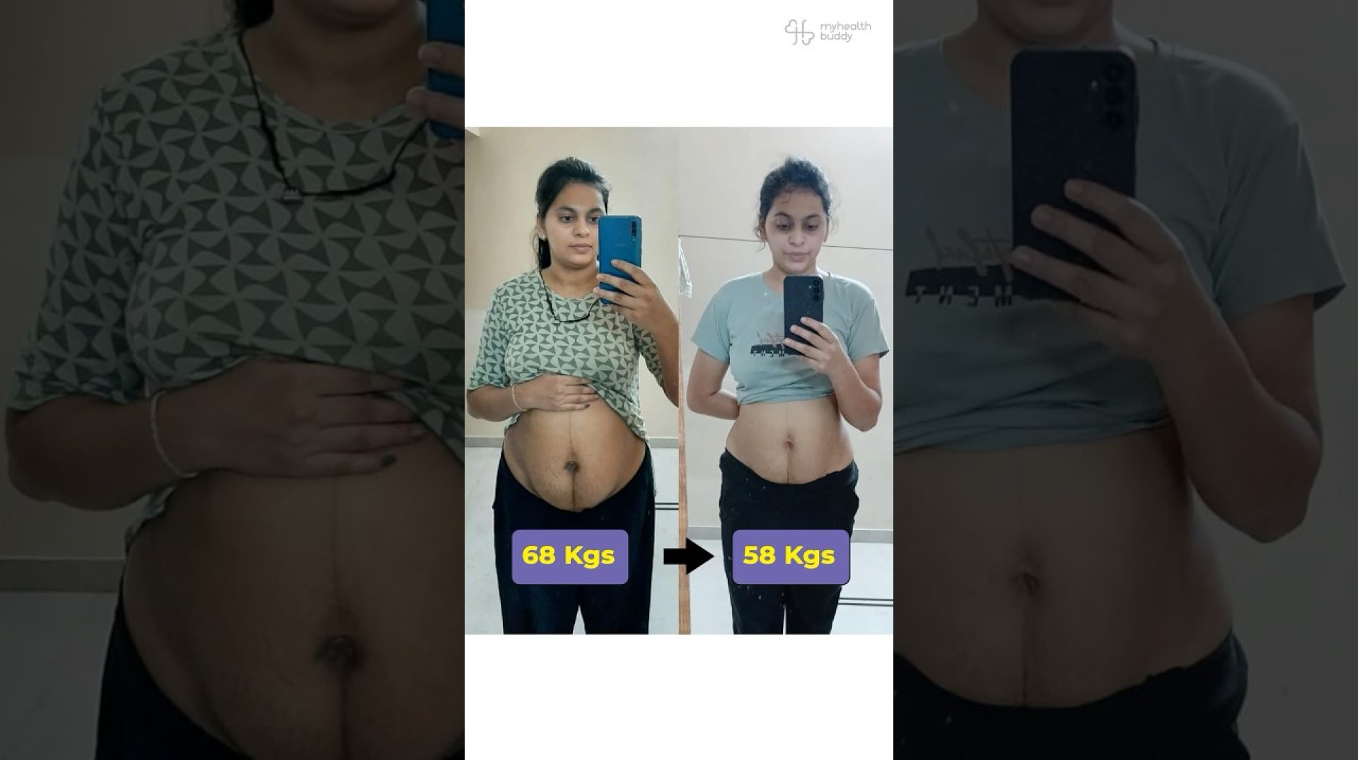 10 Kgs Belly Fat loss Post Delivery (Postpartum Journey) 10 Kgs Belly Fat loss Post Delivery (Postpartum Journey)