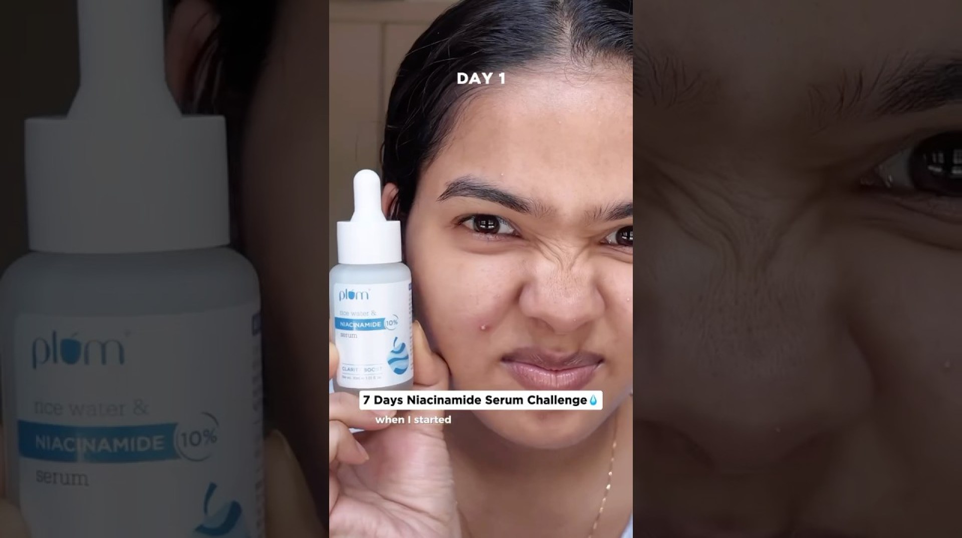 I applied niacinamide serum for 7 days #trendingonshorts #challenge I applied niacinamide serum for 7 days #trendingonshorts #challenge