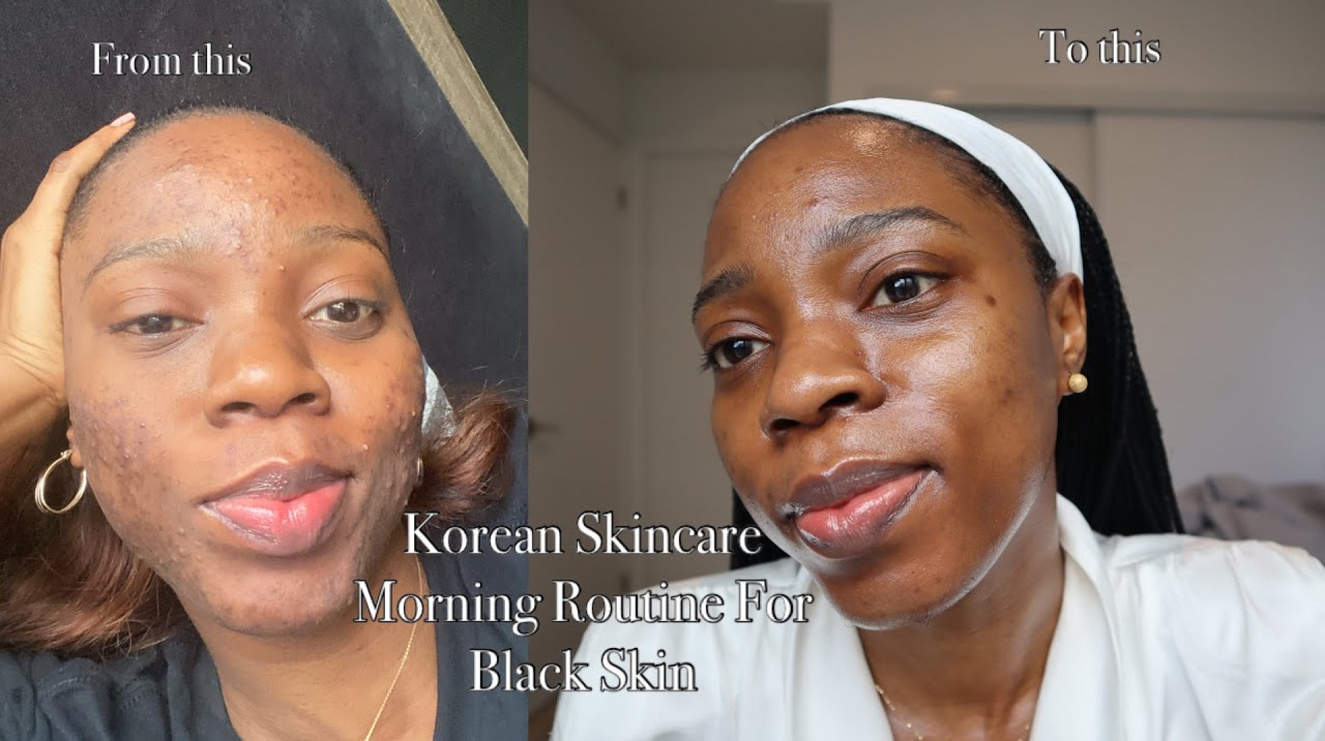 KOREAN SKINCARE MORNING ROUTINE FOR BLACK ACNE PRONE SKIN KOREAN SKINCARE MORNING ROUTINE FOR BLACK ACNE PRONE SKIN