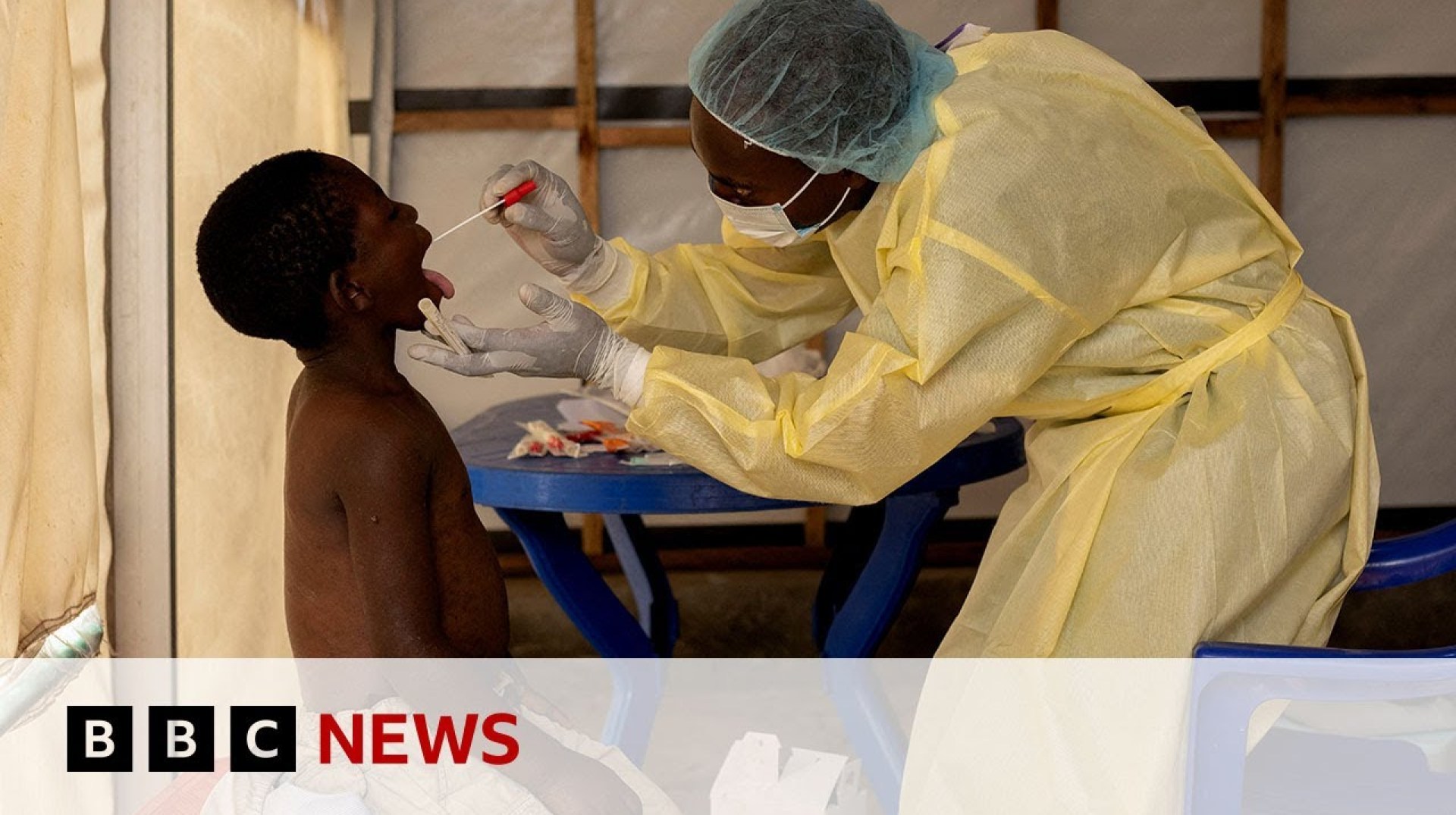 More mpox expected in Europe over the coming weeks, World Health Organization warns | BBC News More mpox expected in Europe over the coming weeks, World Health Organization warns | BBC News