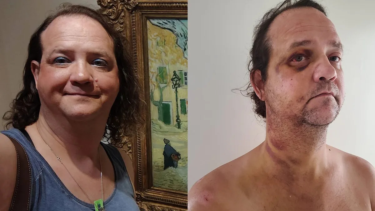 Transgender lady who escaped Alabama for her security overwhelmed & left for useless close to Nationwide Mall in D.C. Transgender lady who escaped Alabama for her security overwhelmed & left for useless close to Nationwide Mall in D.C.