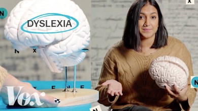 Why the dyslexic brain is misunderstood Why the dyslexic brain is misunderstood