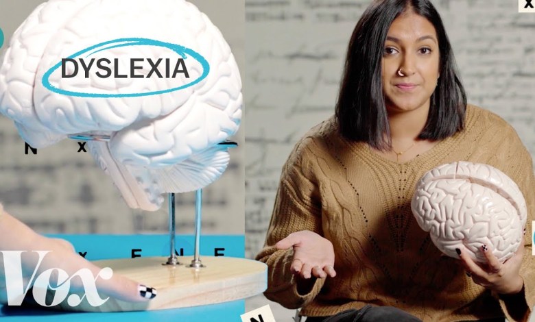 Why the dyslexic brain is misunderstood Why the dyslexic brain is misunderstood