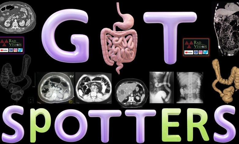 GIT SPOTTERS GIT SPOTTERS