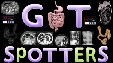 GIT SPOTTERS GIT SPOTTERS