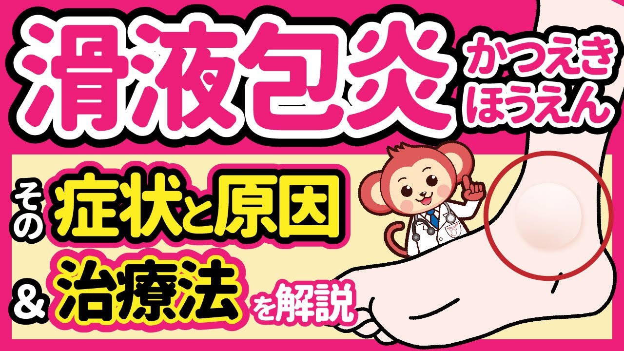 滑液包炎の原因を知る 滑液包炎の原因を知る