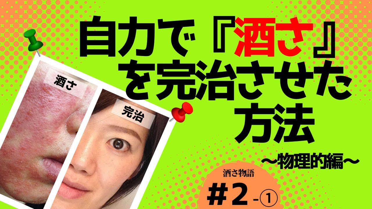 酒さを制御するためのヒント 酒さを制御するためのヒント