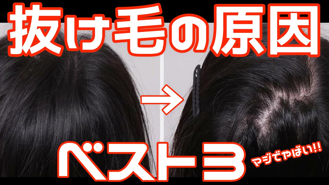 助けてください、髪の毛が抜けてしまいます。ハゲの原因は何ですか? 助けてください、髪の毛が抜けてしまいます。ハゲの原因は何ですか?