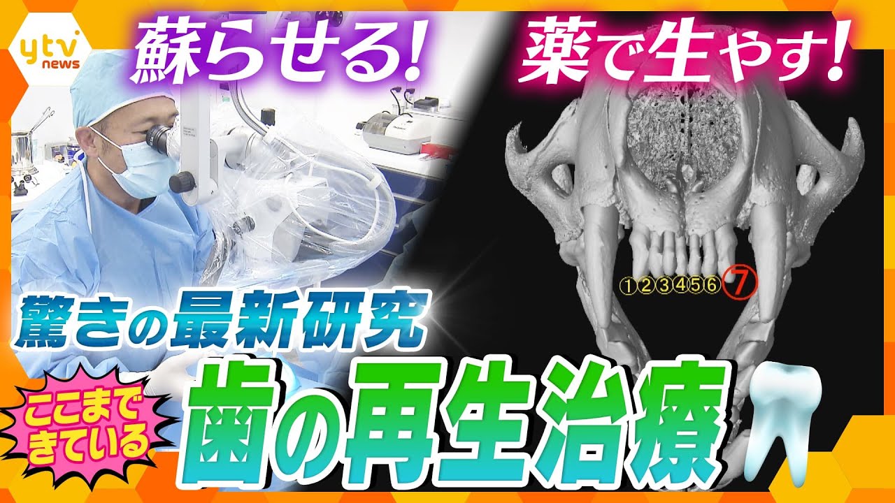 研究者は人間の失われた歯を再生できる薬を開発しました 研究者は人間の失われた歯を再生できる薬を開発しました
