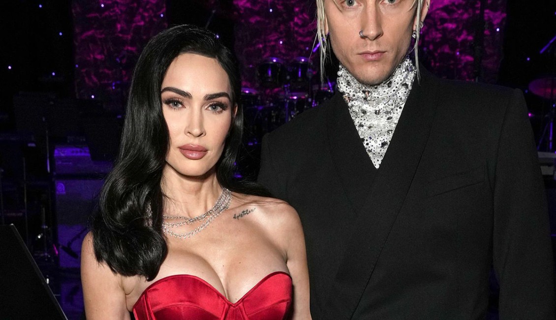 Megan Fox Attends Grammys Bash With Broken Wrist and Concussion Megan Fox Attends Grammys Bash With Broken Wrist and Concussion