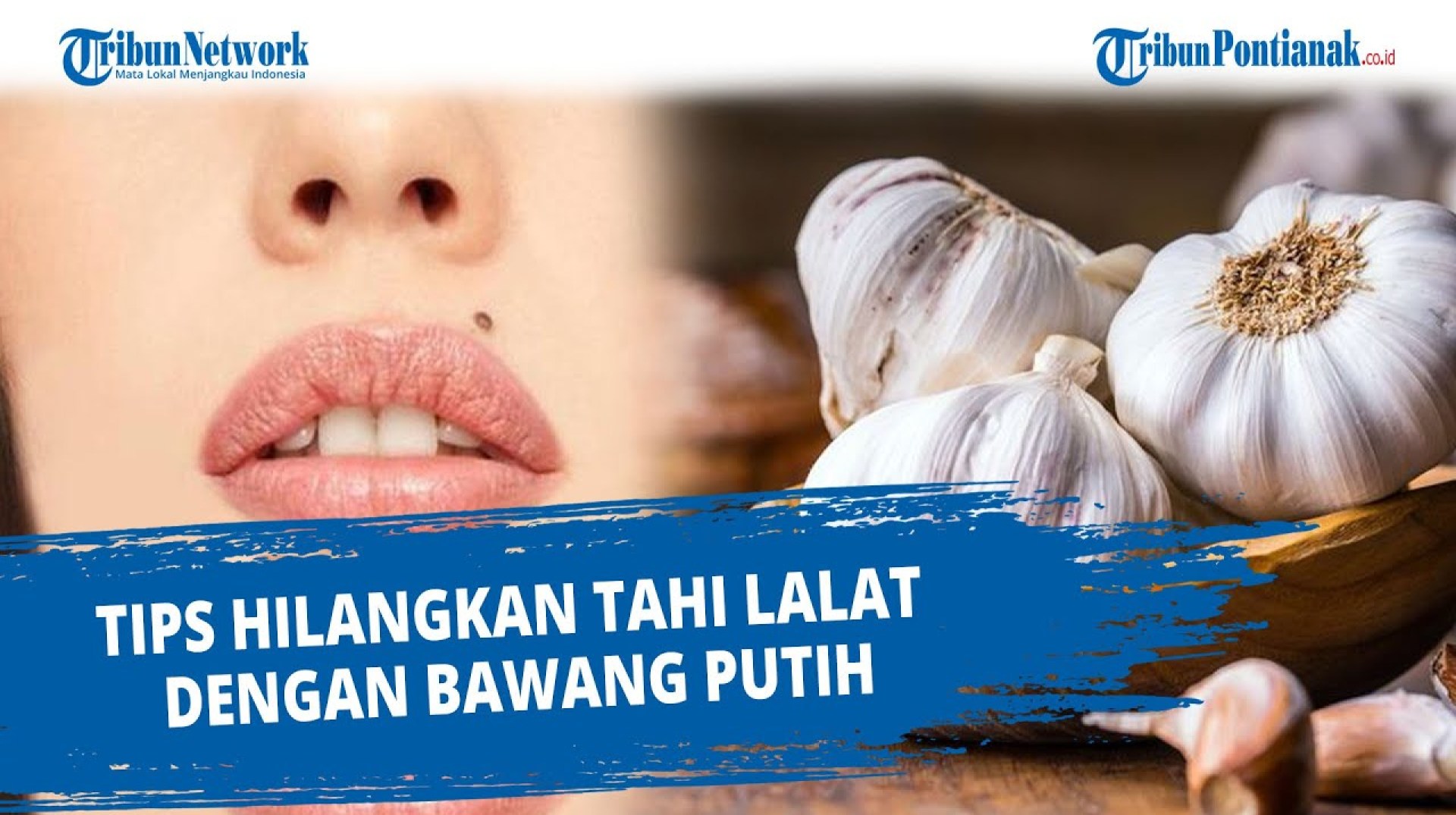 Menghilangkan Tahi Lalat: Panduan Lengkap Dan Aman Menghilangkan Tahi Lalat: Panduan Lengkap Dan Aman