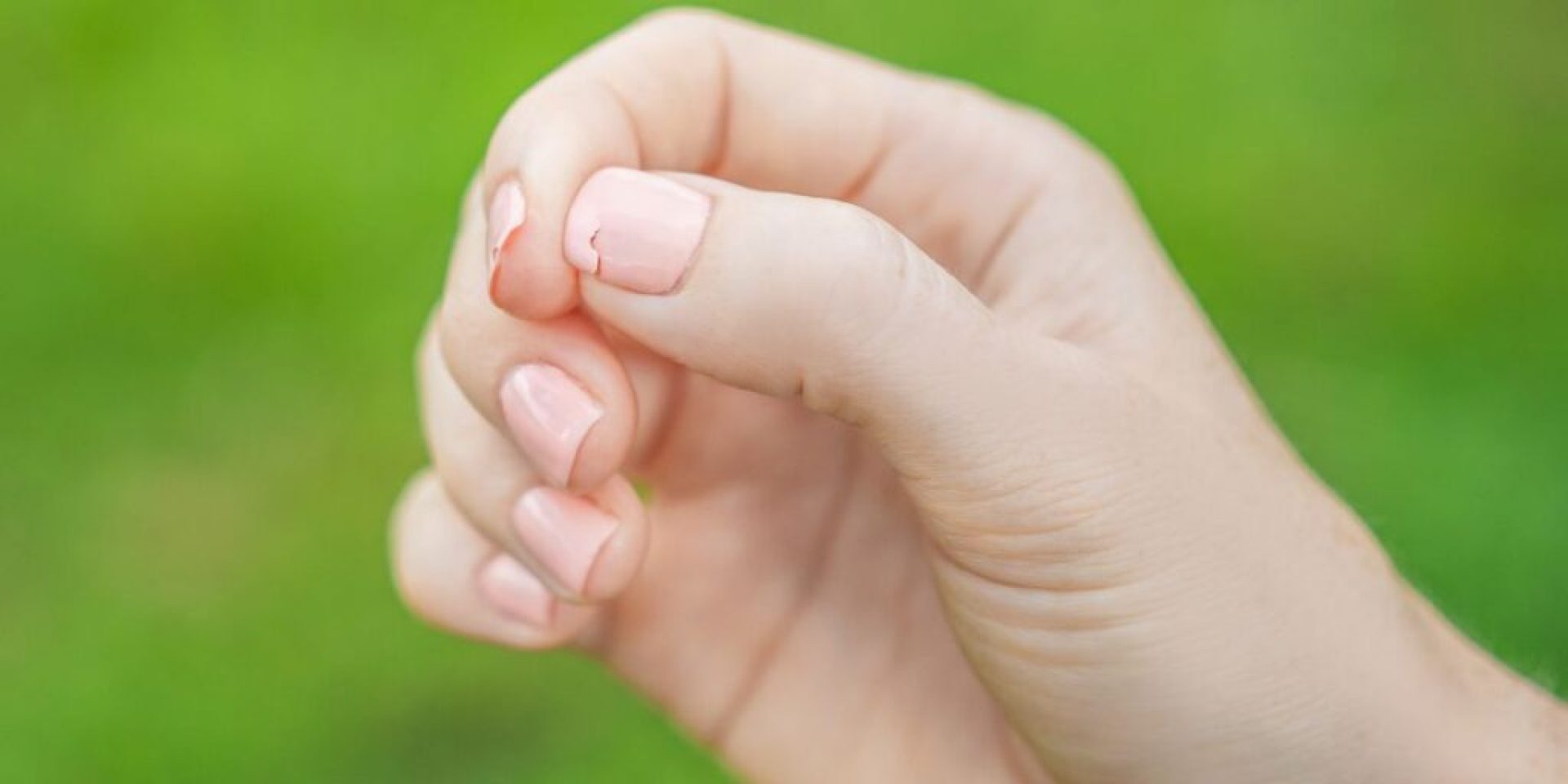 How Do You Prevent Nail Breakage and Splitting? How Do You Prevent Nail Breakage and Splitting?