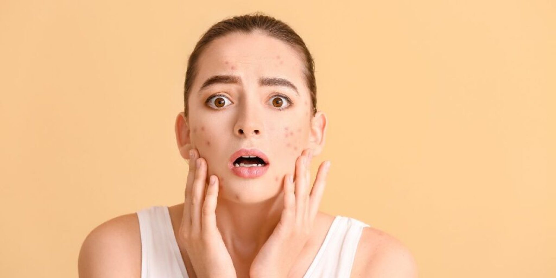 What Are the Best Tips for Reducing Acne and Breakouts? What Are the Best Tips for Reducing Acne and Breakouts?