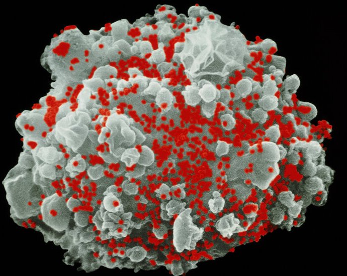 Used in Covid Shots, mRNA May Help Rid the Body of H.I.V. Used in Covid Shots, mRNA May Help Rid the Body of H.I.V.