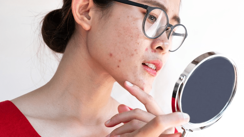 Doctorly Accutane And Alcohol Doctorly Accutane And Alcohol