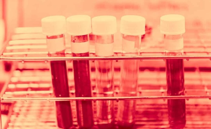 Namibia: Justice Ministry Shuts Down Calls for Mandatory DNA Testing Amid Gender Bias Debate Namibia: Justice Ministry Shuts Down Calls for Mandatory DNA Testing Amid Gender Bias Debate