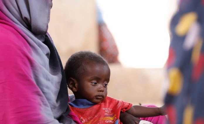 Sudan: Malnutrition Crisis Deepens for Sudan’s Children As War Rages On Sudan: Malnutrition Crisis Deepens for Sudan’s Children As War Rages On