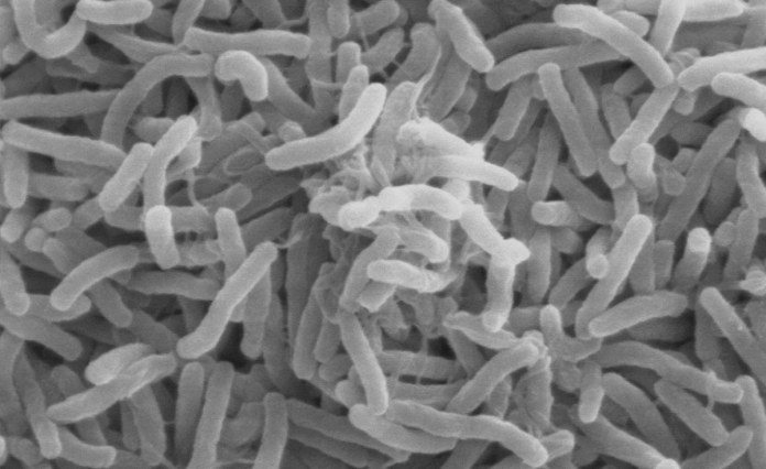 Namibia: No Cholera Cases Recorded in Over a Decade Namibia: No Cholera Cases Recorded in Over a Decade
