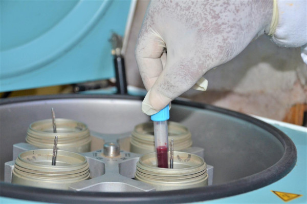 Guarding against antimicrobial resistance in Liberia Guarding against antimicrobial resistance in Liberia
