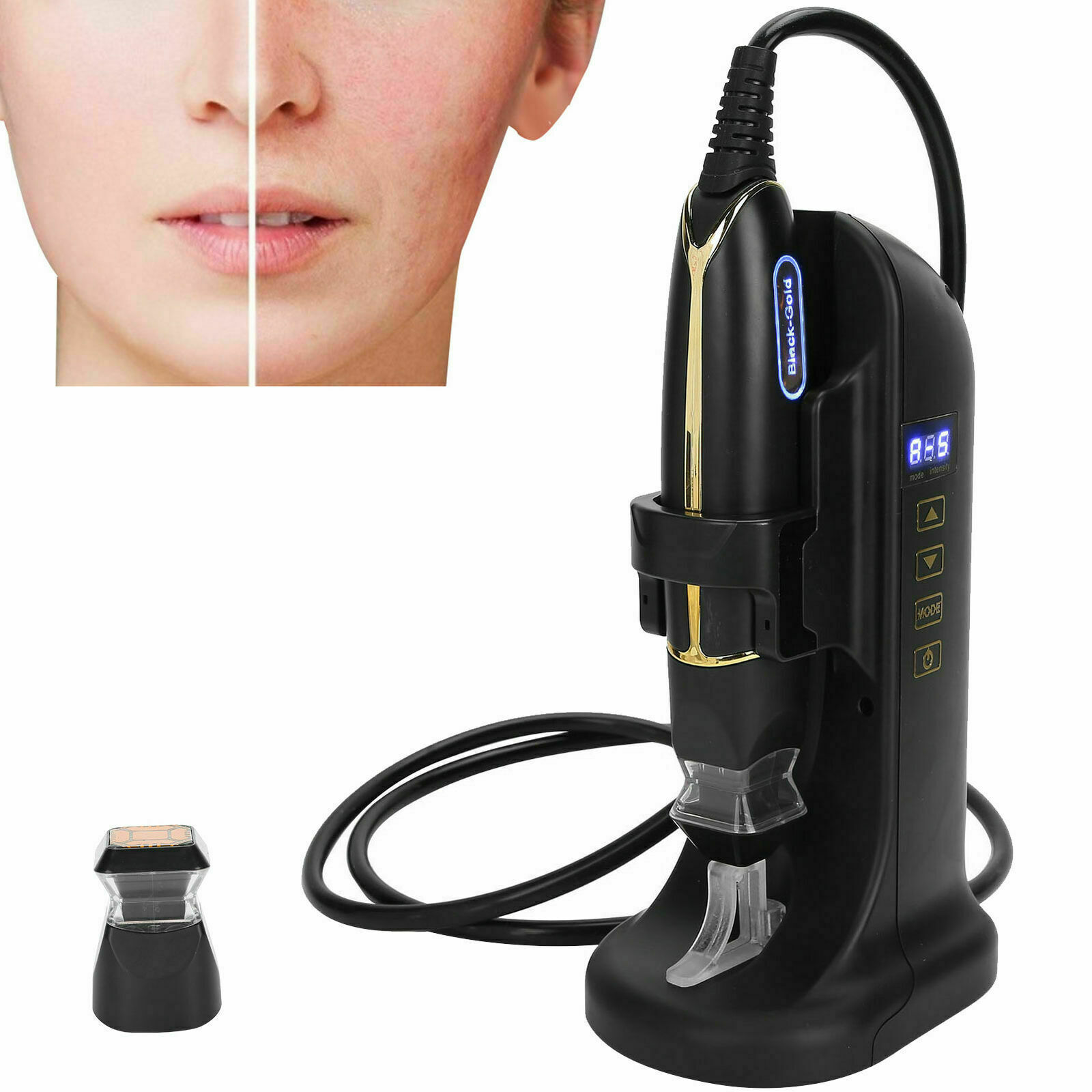 RF Fractional Micro-Needle Beauty Machine Facial Lifting Tighten Wrinkle Removal RF Fractional Micro-Needle Beauty Machine Facial Lifting Tighten Wrinkle Removal