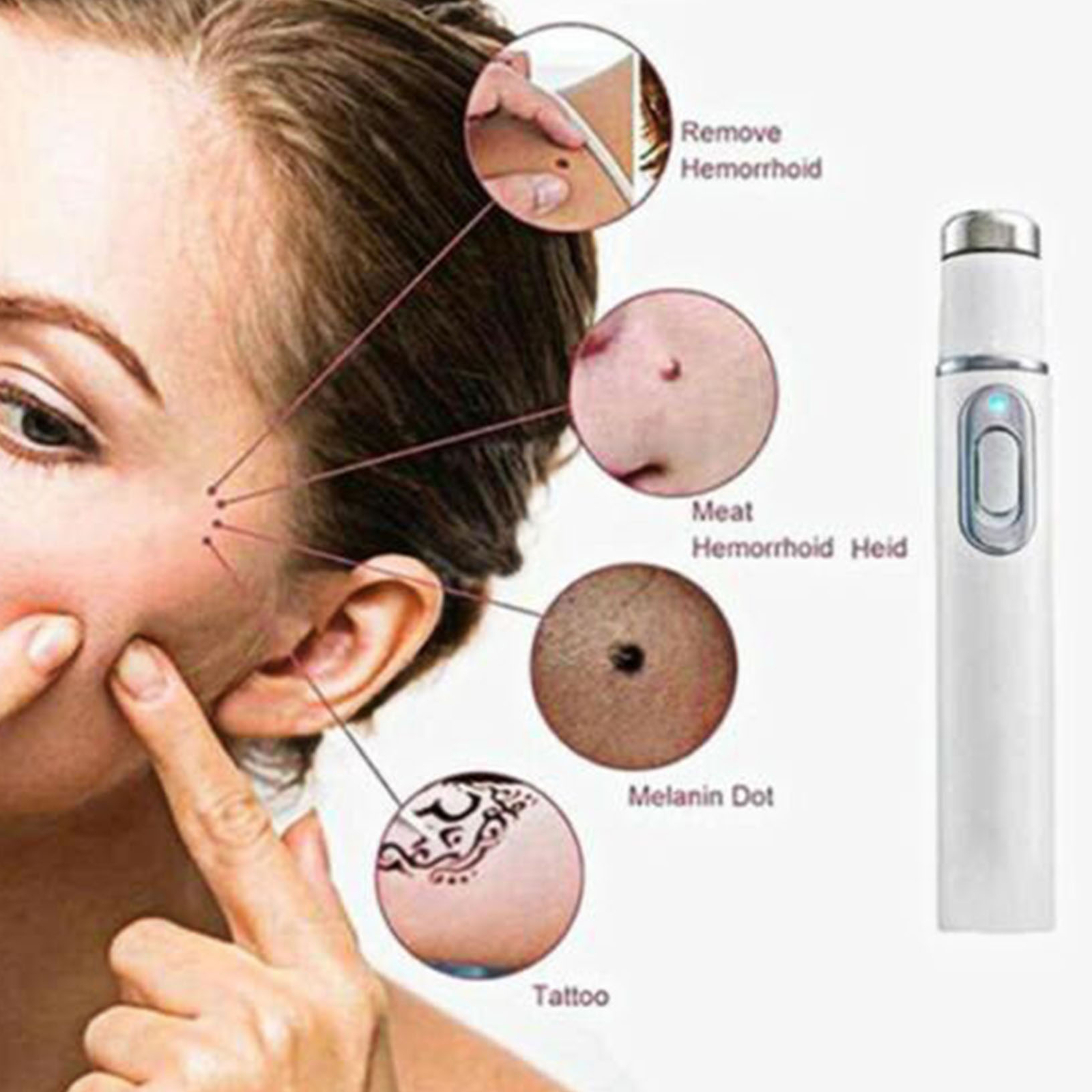 NEW Skin Spots Removal Pen Beauty Blue Light Pen High Quality Free Shipping NEW Skin Spots Removal Pen Beauty Blue Light Pen High Quality Free Shipping