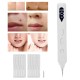LED Display Household Electric Spots Removal Pen Skin Tag Remover Skin Beauty LED Display Household Electric Spots Removal Pen Skin Tag Remover Skin Beauty