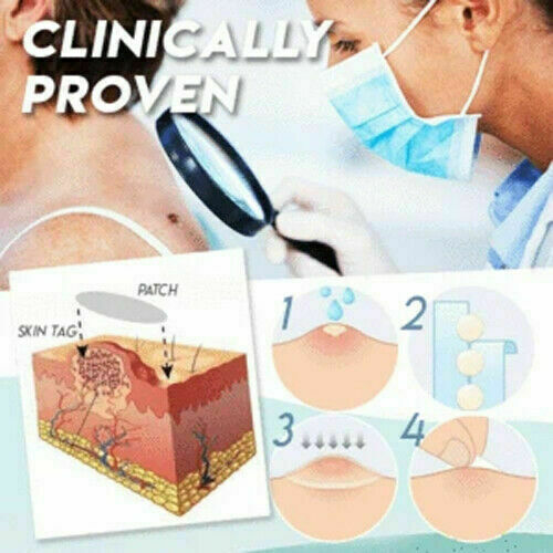 36Pcs Dermopatchy Acne Skin Tag Pimple Remover Patch Removal Facial Care Spot AU 36Pcs Dermopatchy Acne Skin Tag Pimple Remover Patch Removal Facial Care Spot AU