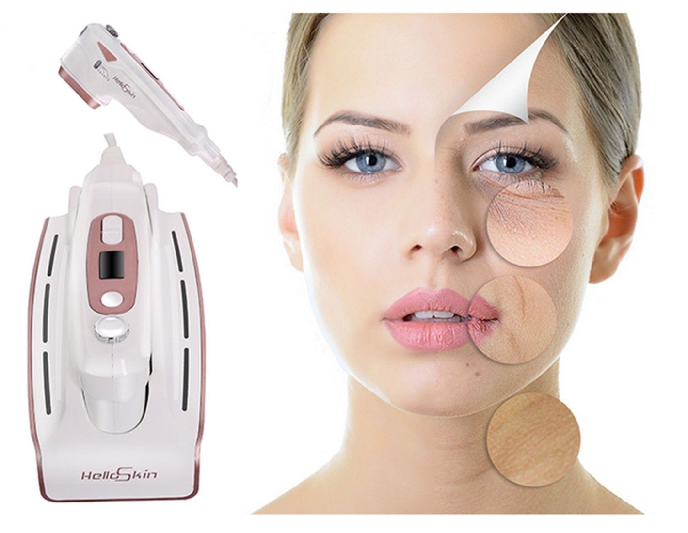 HelloSkin HIFU Ultrasound Skin Care Lifting Anti-Wrinkle Facial Beauty Machine HelloSkin HIFU Ultrasound Skin Care Lifting Anti-Wrinkle Facial Beauty Machine