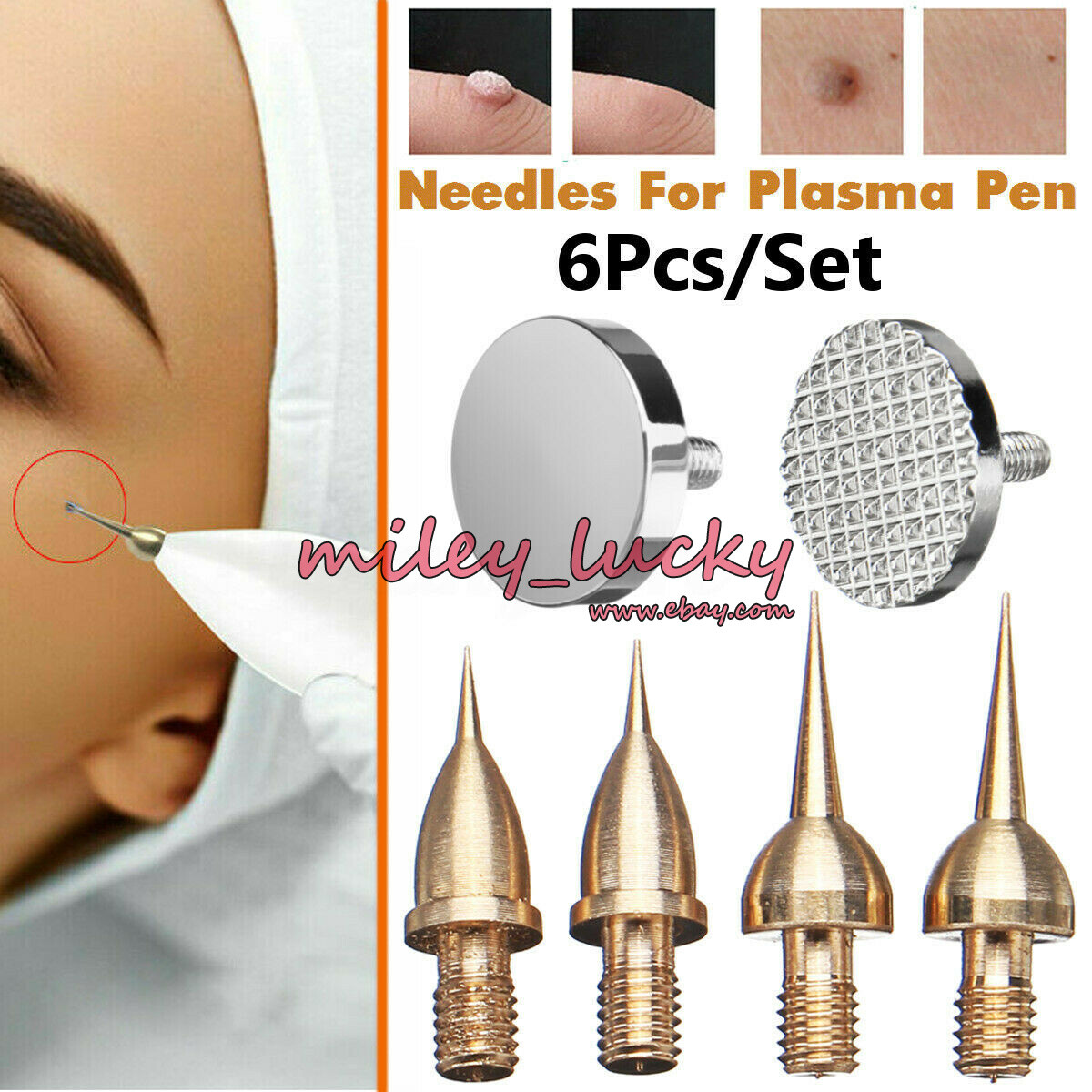 6pcs Beauty Monster Fibroblast Plasma Spot Tattoo Removal Needle Replacements 6pcs Beauty Monster Fibroblast Plasma Spot Tattoo Removal Needle Replacements