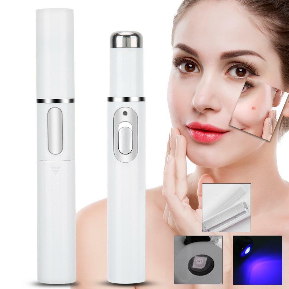 2-in-1 Anti-Acne Electronic Blue Light Repairing Beauty Machine Varicose Veins 2-in-1 Anti-Acne Electronic Blue Light Repairing Beauty Machine Varicose Veins