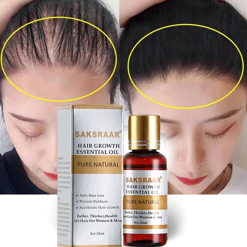 Hair Care Hair Growth Essential Oils Essence Original Authentic Hair Loss