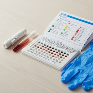 음식물 과민증 검사 음식물 과민증 검사