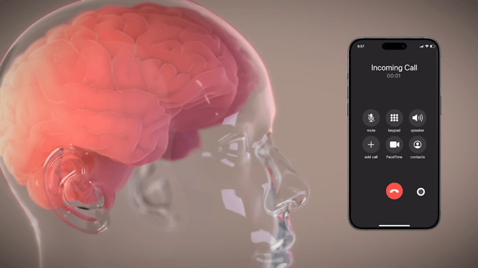 Elon Musk’s Neuralink plans a brain speech trial in October Elon Musk’s Neuralink plans a brain speech trial in October