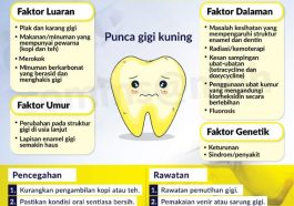 Teh Dan Khasiatnya Untuk Menjaga Kesehatan Gigi Teh Dan Khasiatnya Untuk Menjaga Kesehatan Gigi