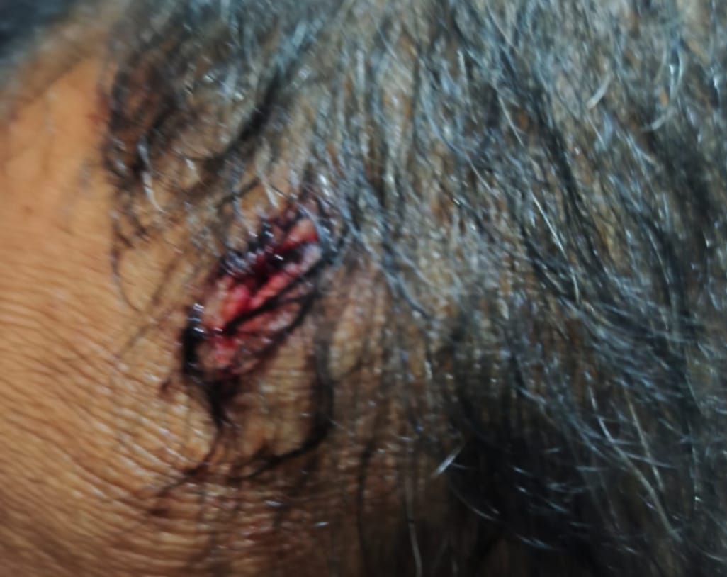 Suami Istri Asal Rajeg Korban Penganiayaan di Pandeglang Suami Istri Asal Rajeg Korban Penganiayaan di Pandeglang