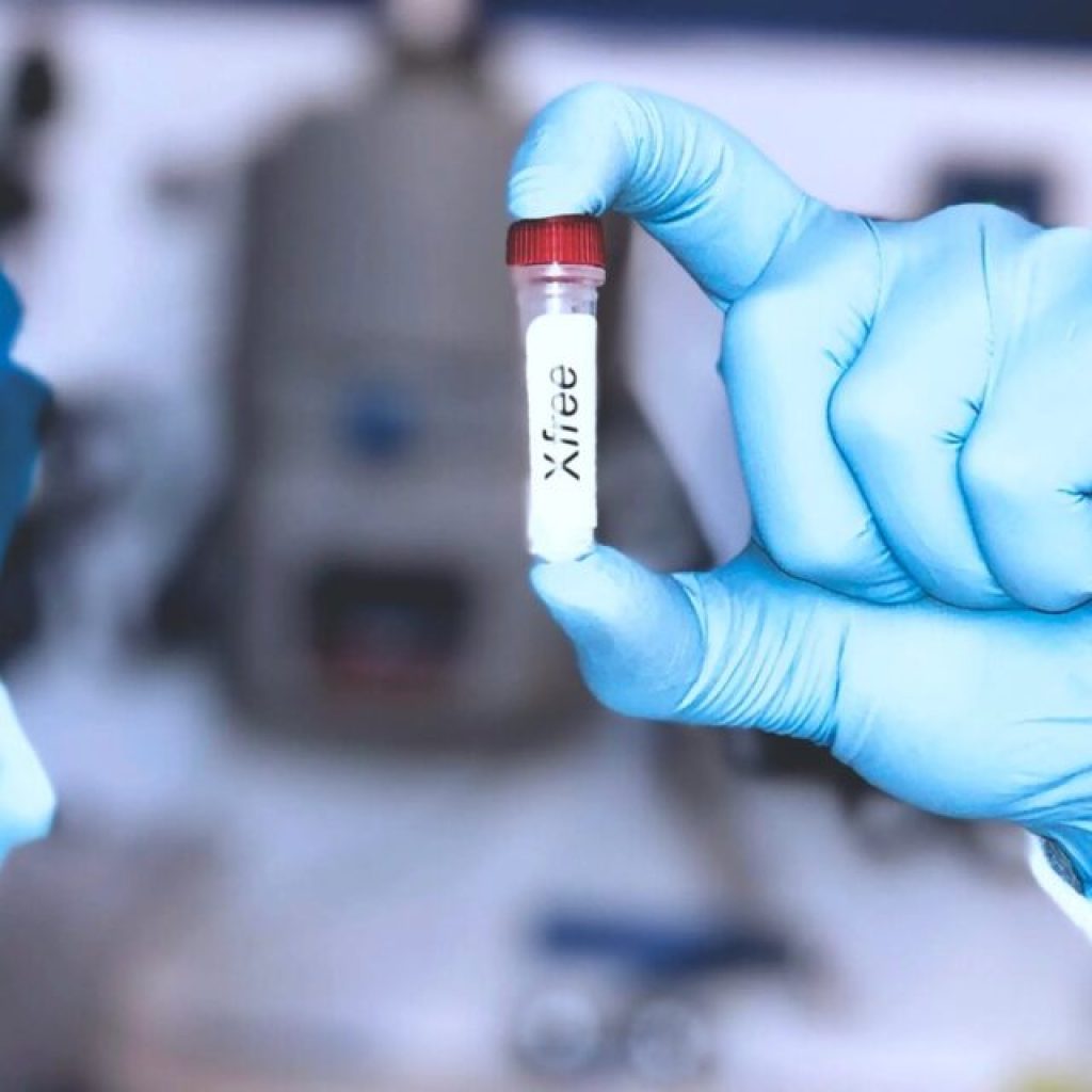 Alabama’s first 2 cases of monkeypox confirmed—what you should know Alabama’s first 2 cases of monkeypox confirmed—what you should know