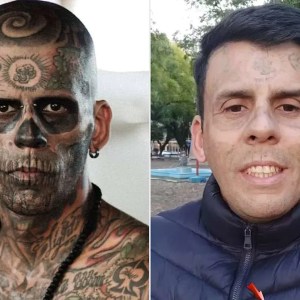 Brazil’s Most Tattooed Man Reveals Shocking Transformation After Tattoo Removal Brazil’s Most Tattooed Man Reveals Shocking Transformation After Tattoo Removal