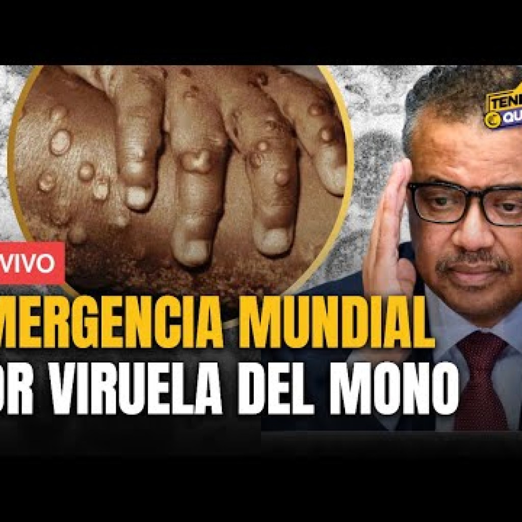 OMS declara emergencia mundial por VIRUELA DEL MONO: ¿Cómo se transmite el MPOX y qué ocurre en Perú? | Tenemos que Hablar OMS declara emergencia mundial por VIRUELA DEL MONO: ¿Cómo se transmite el MPOX y qué ocurre en Perú? | Tenemos que Hablar