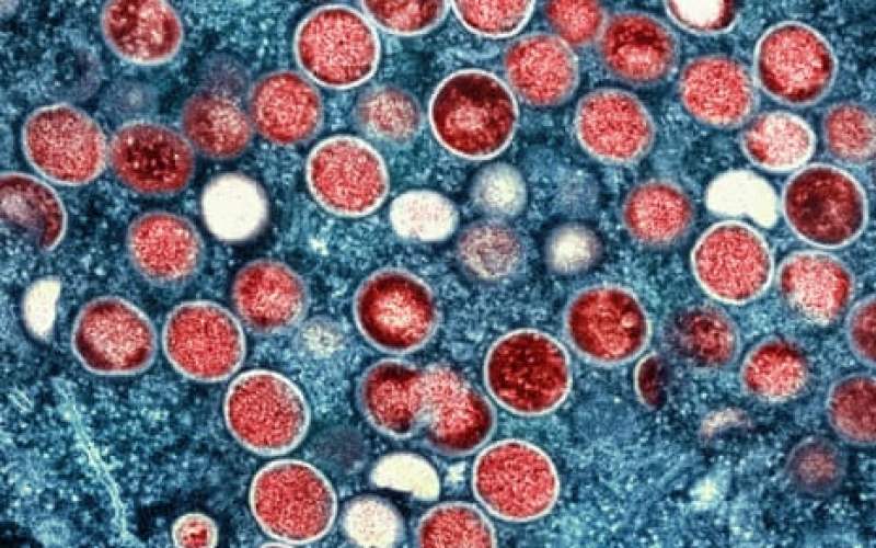 WHO Considers Global Emergency Status for Monkeypox Spread in Africa WHO Considers Global Emergency Status for Monkeypox Spread in Africa