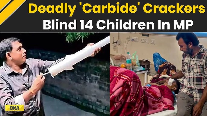 14 Children Lose Eyesight In Madhya Pradesh Playing With ‘Carbide Gun’ Cracker On Diwali 14 Children Lose Eyesight In Madhya Pradesh Playing With ‘Carbide Gun’ Cracker On Diwali