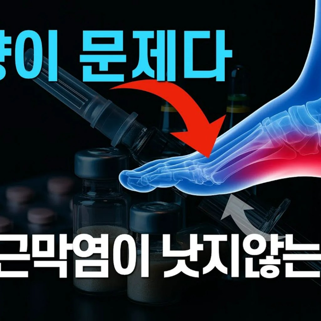 족저근막염 재발의 굴레, 아픈 발바닥이 아닌 ‘발등’에 답이 있습니다 족저근막염 재발의 굴레, 아픈 발바닥이 아닌 ‘발등’에 답이 있습니다