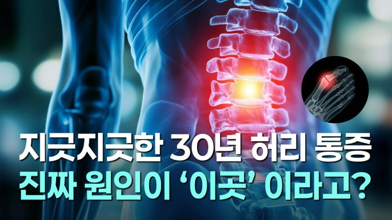 30년 허리 통증의 진범이 발가락? 원인 불명 통증을 해결하는 스본스도(SbonSdo)의 논리 30년 허리 통증의 진범이 발가락? 원인 불명 통증을 해결하는 스본스도(SbonSdo)의 논리