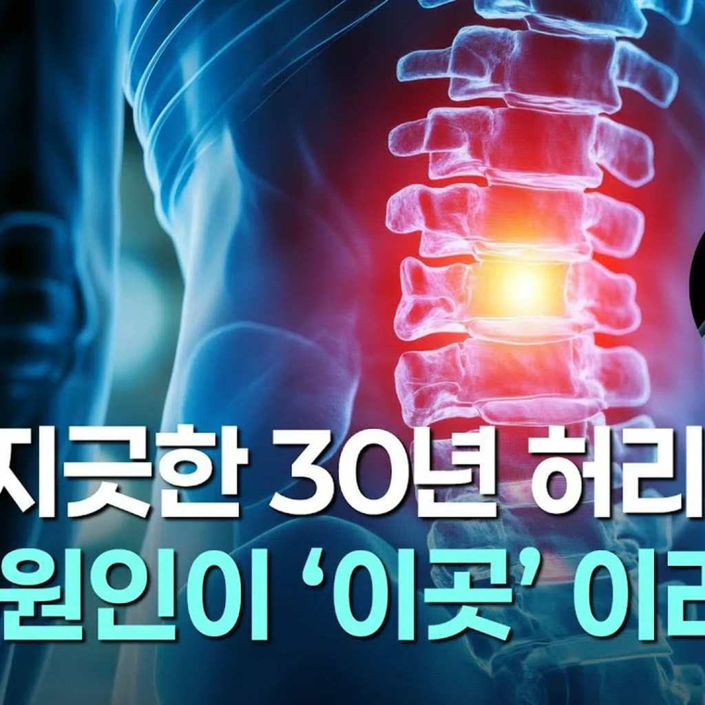 30년 허리 통증의 진범이 발가락? 원인 불명 통증을 해결하는 스본스도(SbonSdo)의 논리 30년 허리 통증의 진범이 발가락? 원인 불명 통증을 해결하는 스본스도(SbonSdo)의 논리