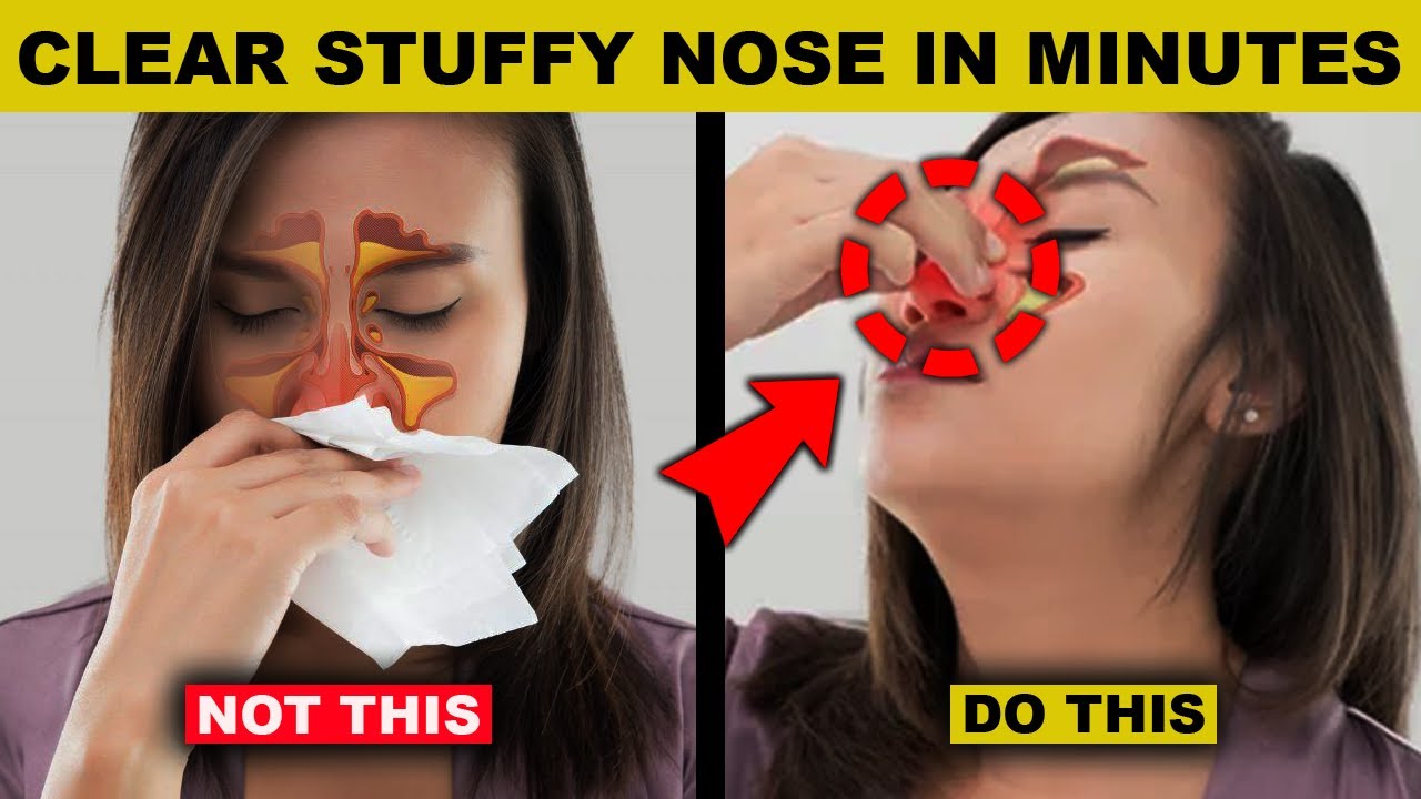 Simple Tricks To Relieve Stuffy Nose In Minutes Simple Tricks To Relieve Stuffy Nose In Minutes