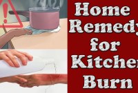 Treat Minor Burns At Home With This Kitchen Ingredient Treat Minor Burns At Home With This Kitchen Ingredient
