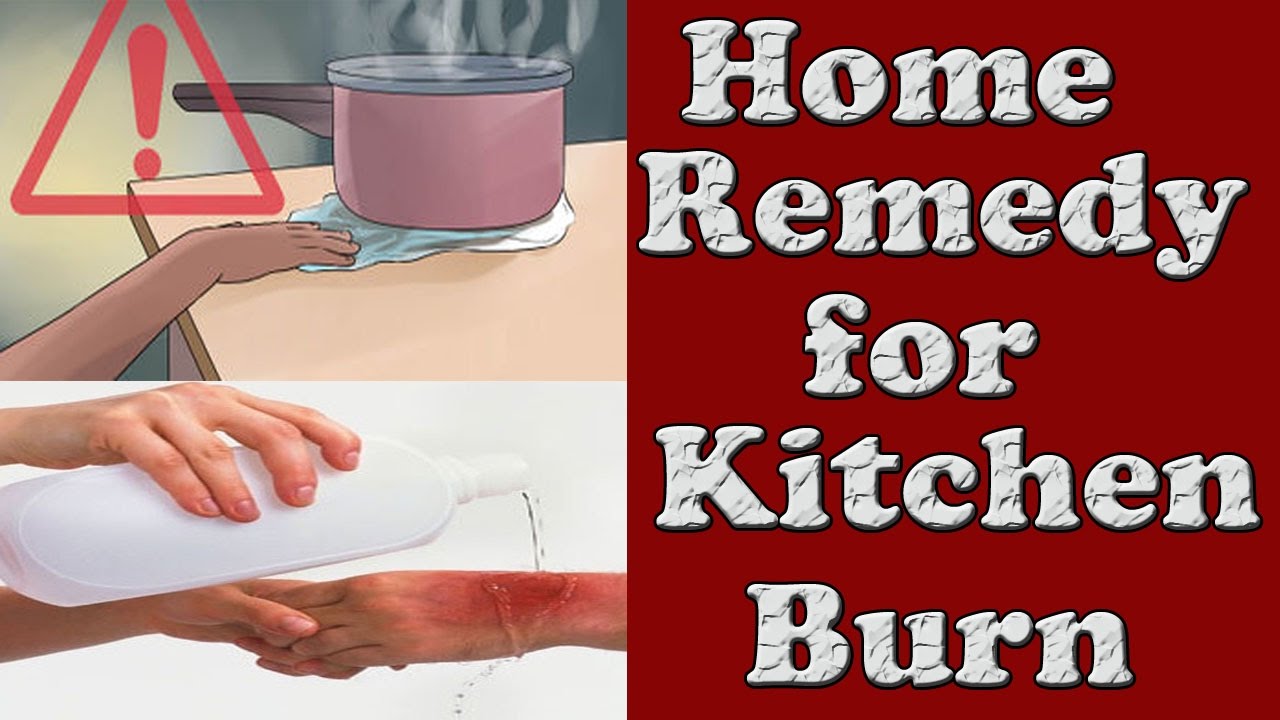 Treat Minor Burns At Home With This Kitchen Ingredient Treat Minor Burns At Home With This Kitchen Ingredient